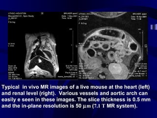 Typical in vivo MR images of a live mouse at the heart (left)
and renal level (right). Various vessels and aortic arch can
easily e seen in these images. The slice thickness is 0.5 mm
and the in-plane resolution is 50 µm (7.1 T MR system).
 
