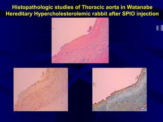 Histopathologic studies of Thoracic aorta in Watanabe
Hereditary Hypercholesterolemic rabbit after SPIO injection
H&E staining
Iron staining
Iron staining
 