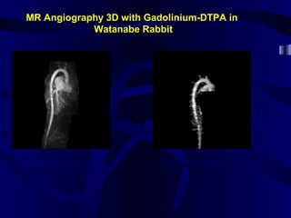 MR Angiography 3D with Gadolinium-DTPA in
Watanabe Rabbit
Before SPIO injection After SPIO injection
 
