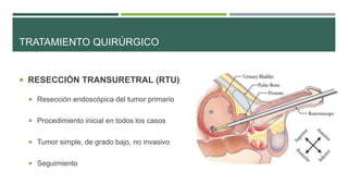 TRATAMIENTO QUIRÚRGICO 
 RESECCIÓN TRANSURETRAL (RTU) 
 Resección endoscópica del tumor primario 
 Procedimiento inicial en todos los casos 
 Tumor simple, de grado bajo, no invasivo 
 Seguimiento 
 