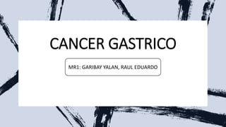 CANCER GASTRICO
MR1: GARIBAY YALAN, RAUL EDUARDO
 