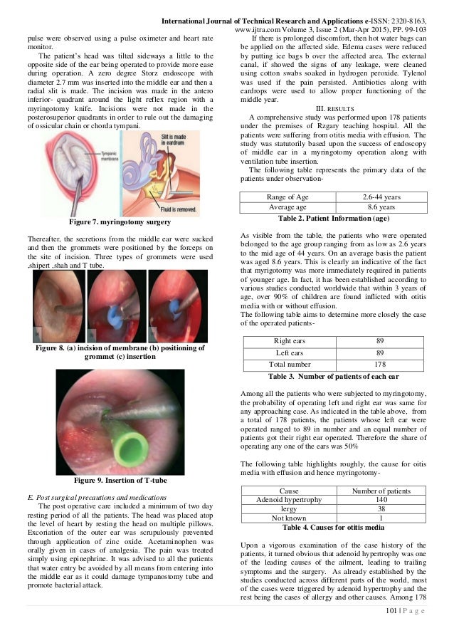 ENDOSCOPIC INSERTION OF TYMPANOSTOMY TUBE IN CHILDREN
