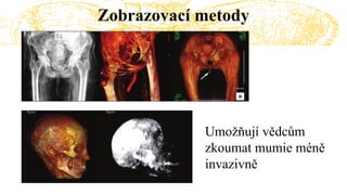 Zobrazovací metody
Umožňují vědcům
zkoumat mumie méně
invazivně
 