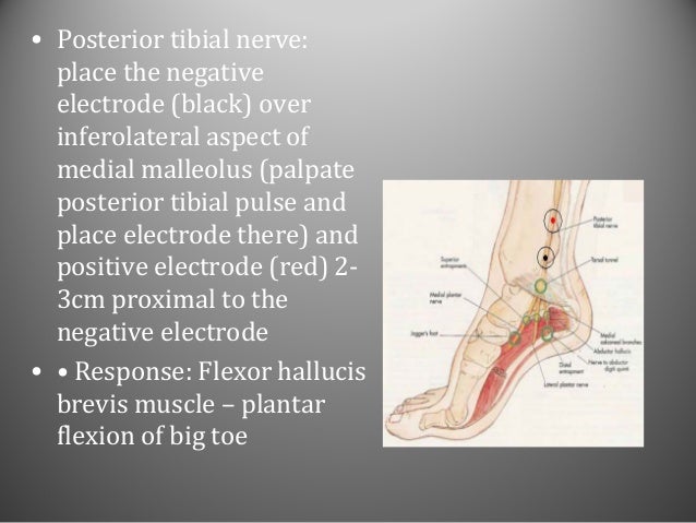 NEUROMUSCULAR MONITORING