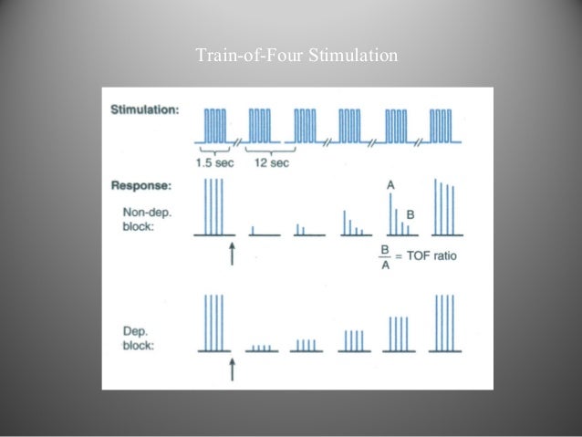 NEUROMUSCULAR MONITORING tetanus diagram 