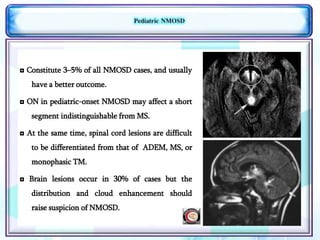 Neuromyelitis Optica Spectrum Disorder | PPTX