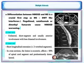 Neuromyelitis Optica Spectrum Disorder | PPTX