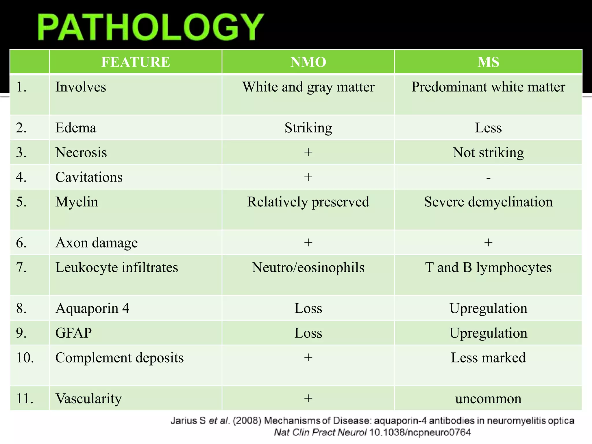 FEATURE NMO MS
1. Involves White and gray matter Predominant white matter
2. Edema Striking Less
3. Necrosis + Not striking
4. Cavitations + -
5. Myelin Relatively preserved Severe demyelination
6. Axon damage + +
7. Leukocyte infiltrates Neutro/eosinophils T and B lymphocytes
8. Aquaporin 4 Loss Upregulation
9. GFAP Loss Upregulation
10. Complement deposits + Less marked
11. Vascularity + uncommon
 