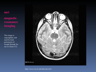 mri
magnetic
resonance
imaging

This image is
copyrighted, and
used by kind
permission of
Joseph Hornak for
use in Chem-312.




                    http://www.cis.rit.edu/htbooks/mri/
 