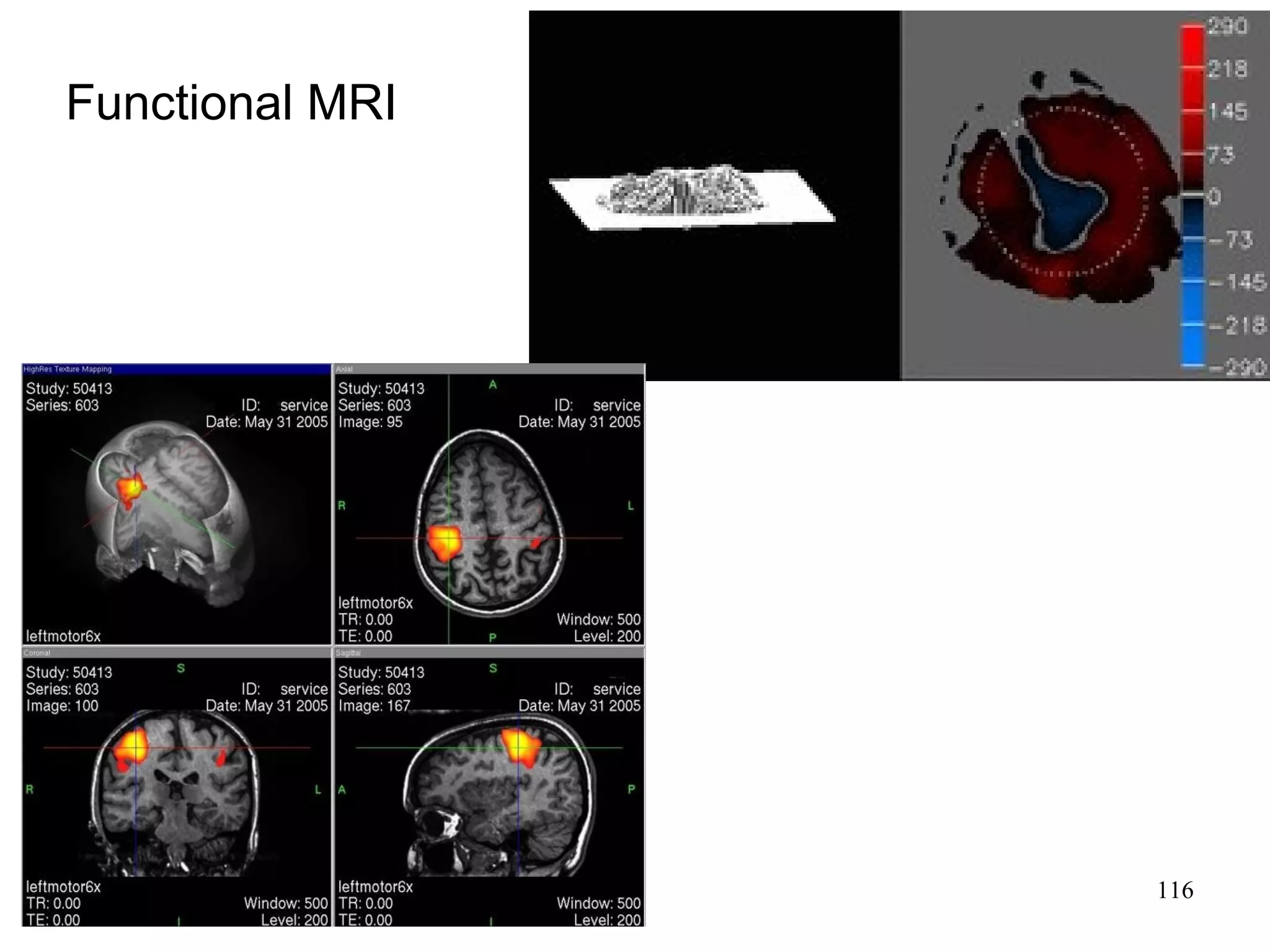 116 
Functional MRI 
 