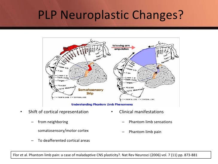 maladaptive brain plasticity phantom limb