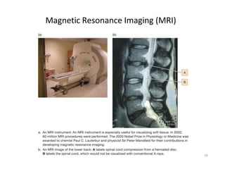 Magnetic Resonance Imaging (MRI)
50
 