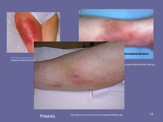 Nmt 631 dvt_imaging-1 | PPT
