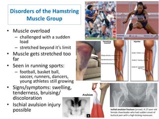 Nmt631 msk lower extremity pathology | PPTX