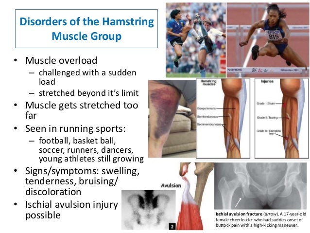 Nmt631 msk lower extremity pathology
