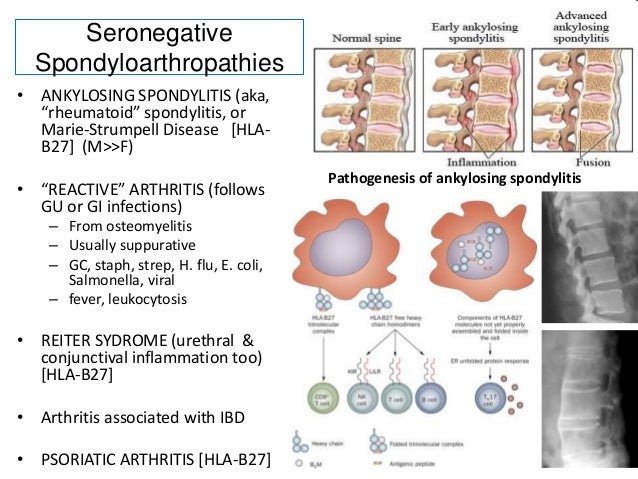 Nmt631 scintigraphy in common bone diseases