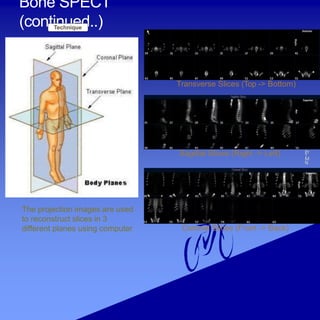 Skeleton systems examination in medical | PPTX