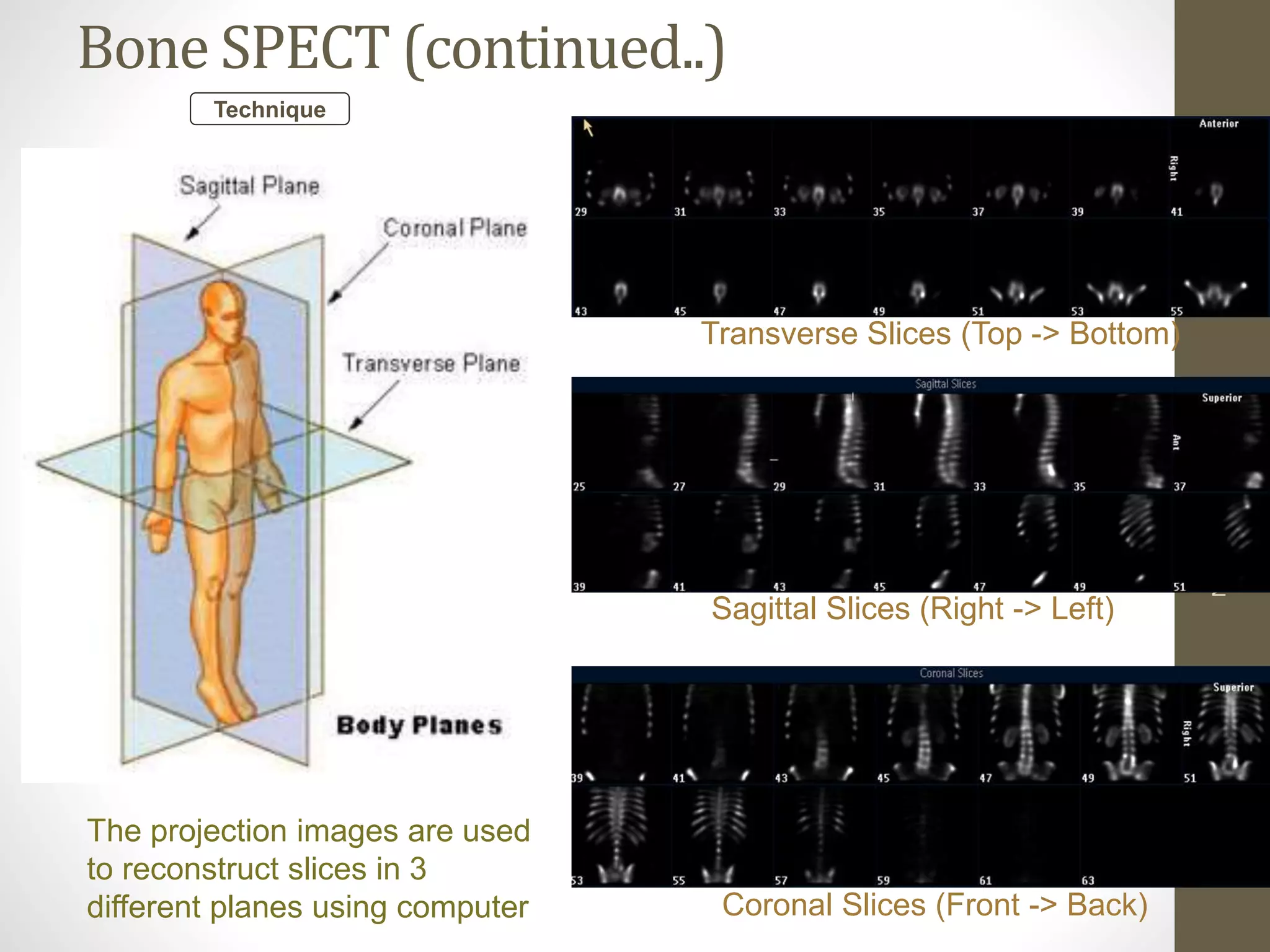 Nmt631 skeletal anat, phys, bone scinti principles | PPTX