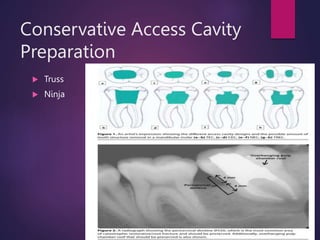 Access opening.pptx