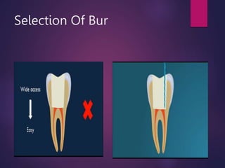 Selection Of Bur
 