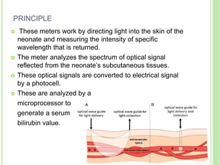 PRINCIPLE
 These meters work by directing light into the skin of the
neonate and measuring the intensity of specific
wavelength that is returned.
 The meter analyzes the spectrum of optical signal
reflected from the neonate’s subcutaneous tissues.
 These optical signals are converted to electrical signal
by a photocell.
 These are analyzed by a
microprocessor to
generate a serum
bilirubin value.
16
 