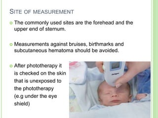 SITE OF MEASUREMENT
 The commonly used sites are the forehead and the
upper end of sternum.
 Measurements against bruises, birthmarks and
subcutaneous hematoma should be avoided.
 After phototherapy it
is checked on the skin
that is unexposed to
the phototherapy
(e.g under the eye
shield) 20
 