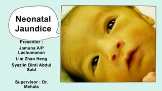 Neonatal
Jaundice
Presentor :
Jamuna A/P
Lachumanan
Lim Zhan Heng
Syazlin Binti Abdul
Said
Supervisor : Dr.
Mehala
 