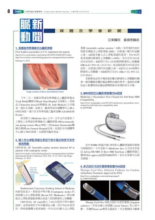 中華民國心律醫學會‧Taiwan Heart Rhythm Society‧中華民國103年3月出刊THRS VOL.0138
1. 美國首例無導線式心臟節律器
First leadless pacemaker in U.S. implanted into patient
http://www.sciencedaily.com/releases/2014/02/140206100734.htm
http://www.healio.com/cardiology/practice-management/news/online/
February 6, 2014
　　今年二月，美國首例迷你無導線式心臟節律器由
Vivek Reddy醫師在Mount Sinai Hospital 完成植入。該產
品之Nanostim device由聖猶達 (St. Jude Medical) 公司發
表，預計在美國、加拿大、歐洲等50多個醫學中心納入
670位病患，進行安全性與效能之臨床試驗 (LEADLESS
II trial)。
　　而美敦力 (Medtronic Inc) 公司，去年12月也發表了
人類史上首例迷你無導線式心臟節律器 (Micra transcath-
eter pacing system, Micra TPS)，由Clemens Steinwender醫
師在澳洲Linz General Hospital完成，也預計在多個醫學
中心納入780位病患，以證實其臨床效益。
2. 植入性心律監視器在原因不明中風的病患可有效
偵測房顫
CRYSTAL AF: Insertable cardiac monitor detected AF in
patients with cryptogenic stroke
http://www.healio.com/cardiology/practice-management/news/online/
International Stroke Conference 2014; Feb. 12-14, 2014; San Diego.
February 14, 2014
　　Northwestern University Feinberg School of Medicine
的研究員表示，替原因不明中風 (Cryptogenic stroke) 的
病患植入式心律監視器 (Reveal XT, Medtronic)，將比傳
統式心律監視器能偵測出高達六倍的陣發性心房顫動。
　　CRYSTAL AF study納入了441位原因不明中風的
病患，這些病患的平均年齡是61.5歲，其中有63%為男
性。將病患隨機分派成兩組，其中221位植入式心律監
視器 (insertable cardiac monitor，A組)，而其他的220位
則接受傳統式心律監視器 (B組)。在經過六個月的追蹤
之後，A組接受植入式心律監視器的患者，有8.9%的
患者偵測出陣發性心房顫動 (>30秒)，其中有有74%是
沒有症狀的；B組則只有1.4%偵測到陣發性心房顫動
(HR=6.43; 95% CI, 1.9-21.74)，而這組病患有33%是沒有
症狀。在經過12個月的追蹤之後，A組有12.4%偵測出
陣發性心房顫動，而B組則只有2% (HR=7.32; 95% CI,
2.57-20.81)。
　　若能增加這些中風病患診斷出陣發性心房顫動的機
會，做為醫師改變抗凝血藥物治療的參考，適當的改變
抗血小板藥物為抗凝血製劑將能有效預防再次中風。
3. MRI相容性心臟節律器獲FDA認證
Medtronic’s Pacemakers Now Cleared for Full Body MRI
Compatibility
http://www.medgadget.com/2014/01/medtronics-pacemakers-now-
cleared-for-full-body-mri-compatibility.html
by EDITORS
　　近年來MRI (核磁共振) 相容的心臟節律器都有限制
可掃描部位，今年美敦力 (Medtronic Inc) 公司宣布其產
品 Advisa DR MRI 及 Revo MRI SureScan 心臟節律器已
獲得FDA approval認證為MRI相容，而且全身都可以接
受掃描。
4. 新式設計冷卻性電燒導管獲FDA認證
Therapy Cool Flex Ablation Catheter for Cardiac
Arrhythmia Treatment Approved by FDA
http://www.medgadget.com/cardiology/page/2
by TOM FOWLER
　　Therapy Cool Flex 為新式設計冷卻性電燒 (irrigation
catheter)，用來治療心房撲動 (atrial flutter) 等心律不
整。 其獨特laser-cut導管尖端設計，可在電燒時大幅增
媒 體 及 學 會 新 聞
脈 新
動 聞 亞東醫院　黃姍惠醫師
Image courtesy of Mount Sinai Medical Center
 