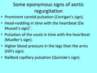 Some eponymous signs of aortic
regurgitation
• Prominent carotid pulsation (Corrigan's sign).
• Head-nodding in time with the heartbeat (De
Musset's sign)*.
• Pulsation of the uvula in time with the heartbeat
(Mueller's sign).
• Higher blood pressure in the legs than the arms
(Hill's sign).
• Nailbed capillary pulsation (Quincke's sign).
 