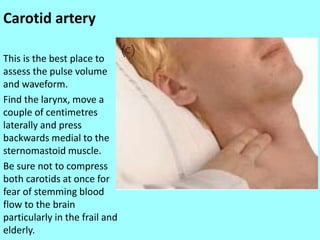 Carotid artery
This is the best place to
assess the pulse volume
and waveform.
Find the larynx, move a
couple of centimetres
laterally and press
backwards medial to the
sternomastoid muscle.
Be sure not to compress
both carotids at once for
fear of stemming blood
flow to the brain
particularly in the frail and
elderly.
 