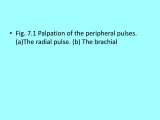 • Fig. 7.1 Palpation of the peripheral pulses.
(a)The radial pulse. (b) The brachial
 