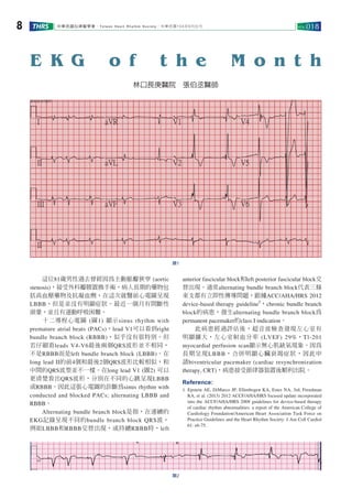 Taiwan Heart Rhythm Society 104 6THRS VOL.0188
2
1
E K G o f t h e M o n t h
81 (aortic
stenosis)
LBBB
( 1) sinus rhythm with
premature atrial beats (PACs) lead V1 right
bundle branch block (RBBB)
leads V4-V6 QRS
RBBB left bundle branch block (LBBB)
long lead II 4 2 QRS
QRS long lead V1 ( 2)
QRS LBBB
RBBB sinus rhythm with
conducted and blocked PACs; alternating LBBB and
RBBB
Alternating bundle branch block
EKG bundle branch block QRS
LBBB RBBB RBBB left
anterior fascicular block left posterior fascicular block
alternating bundle branch block
ACC/AHA/HRS 2012
device-based therapy guideline
1
chronic bundle branch
block alternating bundle branch block
permanent pacemaker class I indication
(LVEF) 29% Tl-201
myocardial perfusion scan
LBBB
biventricular pacemaker (cardiac resynchronization
therapy, CRT)
Reference:
1. Epstein AE, DiMarco JP, Ellenbogen KA, Estes NA, 3rd, Freedman
RA, et al. (2013) 2012 ACCF/AHA/HRS focused update incorporated
into the ACCF/AHA/HRS 2008 guidelines for device-based therapy
of cardiac rhythm abnormalities: a report of the American College of
Cardiology Foundation/American Heart Association Task Force on
Practice Guidelines and the Heart Rhythm Society. J Am Coll Cardiol
61: e6-75.
 