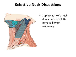 clinically N0 neck in oral cancer | PPTX