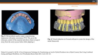 21
Fig. 3: Old prosthesis used to make a repositioning
impression with putty consistency PVS. This gives the
clinicians control of the material and allows them to keep it
away from the screw access holes while adapting it
Fig. 4: Virtual reduction on Exocad software to create the design of the
metal framework
Tohme H, Lawand G, Akl M. A Novel Impression Technique for Transforming an Acrylic Hybrid Prosthesis into a Metal Ceramic One Using Combined
Analog and Digital Workflows. Int J Prosthodont Restor Dent 2021;11(3):138–141.
08/07/2024
 
