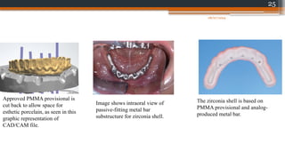 25
Approved PMMA provisional is
cut back to allow space for
esthetic porcelain, as seen in this
graphic representation of
CAD/CAM file.
Image shows intraoral view of
passive-fitting metal bar
substructure for zirconia shell.
The zirconia shell is based on
PMMA provisional and analog-
produced metal bar.
08/07/2024
 