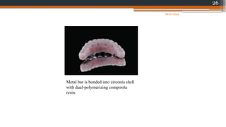 26
Metal bar is bonded into zirconia shell
with dual-polymerizing composite
resin.
08/07/2024
 