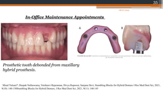 35
In-Office Maintenance Appointments
Prosthetic tooth debonded from maxillary
hybrid prosthesis.
Minal Tulsani*, Deepak Nallaswamy, Vaishnavi Rajaraman, Divya Rupawat, Sanjana Devi, Stumbling Blocks for Hybrid Denture J Res Med Dent Sci, 2021,
9(10): 140-150Stumbling Blocks for Hybrid Denture, J Res Med Dent Sci, 2021, 9(11): 140-145
08/07/2024
 