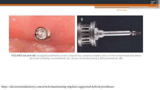 37
https://decisionsindentistry.com/article/maintaining-implant-supported-hybrid-prostheses
08/07/2024
 