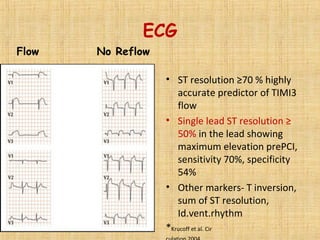 ECG
• ST resolution ≥70 % highly
accurate predictor of TIMI3
flow
• Single lead ST resolution ≥
50% in the lead showing
maximum elevation prePCI,
sensitivity 70%, specificity
54%
• Other markers- T inversion,
sum of ST resolution,
Id.vent.rhythm
*Krucoff et al. Cir
Flow No Reflow
 