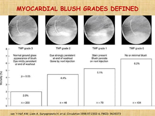 MYOCARDIAL BLUSH GRADES DEFINED
van 't Hof AW, Liem A, Suryapranata H, et al. Circulation 1998;97:2302-6. PMID: 9639373.
 