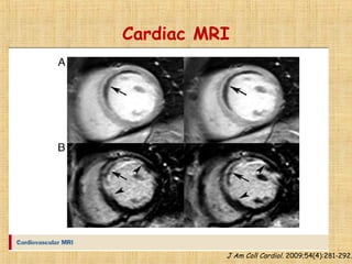 Cardiac MRI
J Am Coll Cardiol. 2009;54(4):281-292.
 