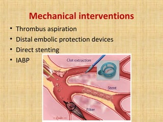 Mechanical interventions
• Thrombus aspiration
• Distal embolic protection devices
• Direct stenting
• IABP
 