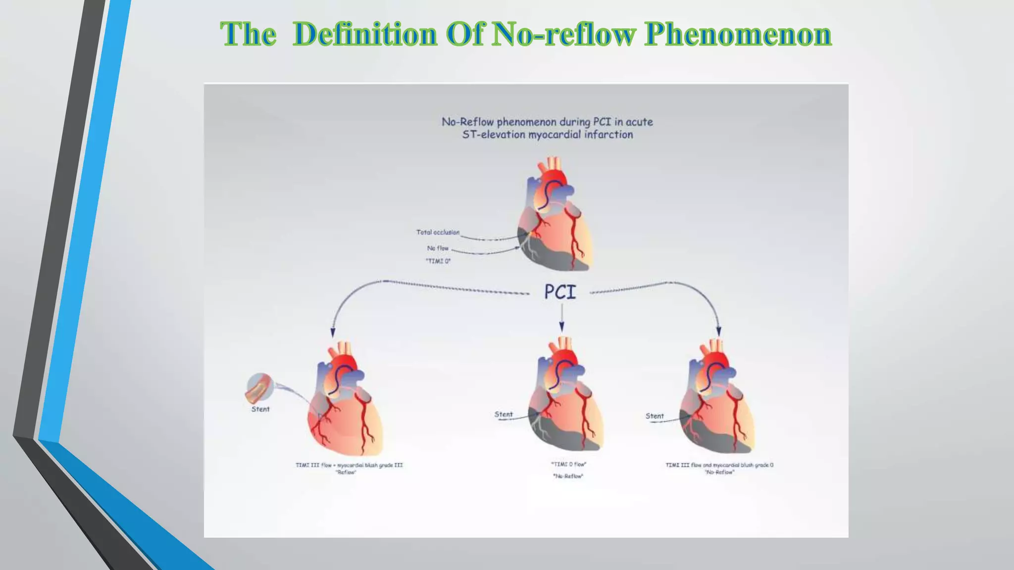 Reflow Definition No-reflow phenomenon | PPTX