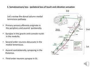 Let’s review the dorsal column medial
lemnsiscus pathway
• Primary sensory afferents originate in
the periphery and ascend...
