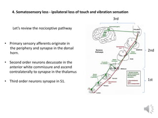 Let’s review the nociceptive pathway
• Primary sensory afferents originate in
the periphery and synapse in the dorsal
horn...