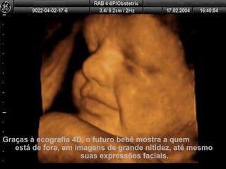 Graças à ecografia 4D, o futuro bebê mostra a quemGraças à ecografia 4D, o futuro bebê mostra a quem
está de fora, em imagens de grande nitidez, até mesmoestá de fora, em imagens de grande nitidez, até mesmo
suas expressões faciais.suas expressões faciais.
 