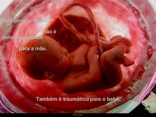Sim, porque o parto  não é doloroso apenas  para a mãe.   Também é traumático para o bebê. 