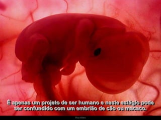 É apenas um projeto de ser humano e neste estágio pode
ser confundido com um embrião de cão ou macaco.
Ria slides

 