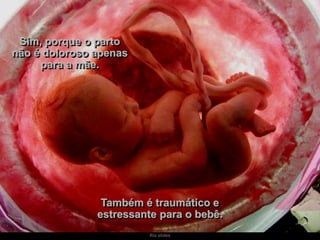 Ria slides
Sim, porque o parto
não é doloroso apenas
para a mãe.
Também é traumático e
estressante para o bebê.
 
