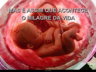 Ria slides
MAS É ASSIM QUE ACONTECE
O MILAGRE DA VIDA
 